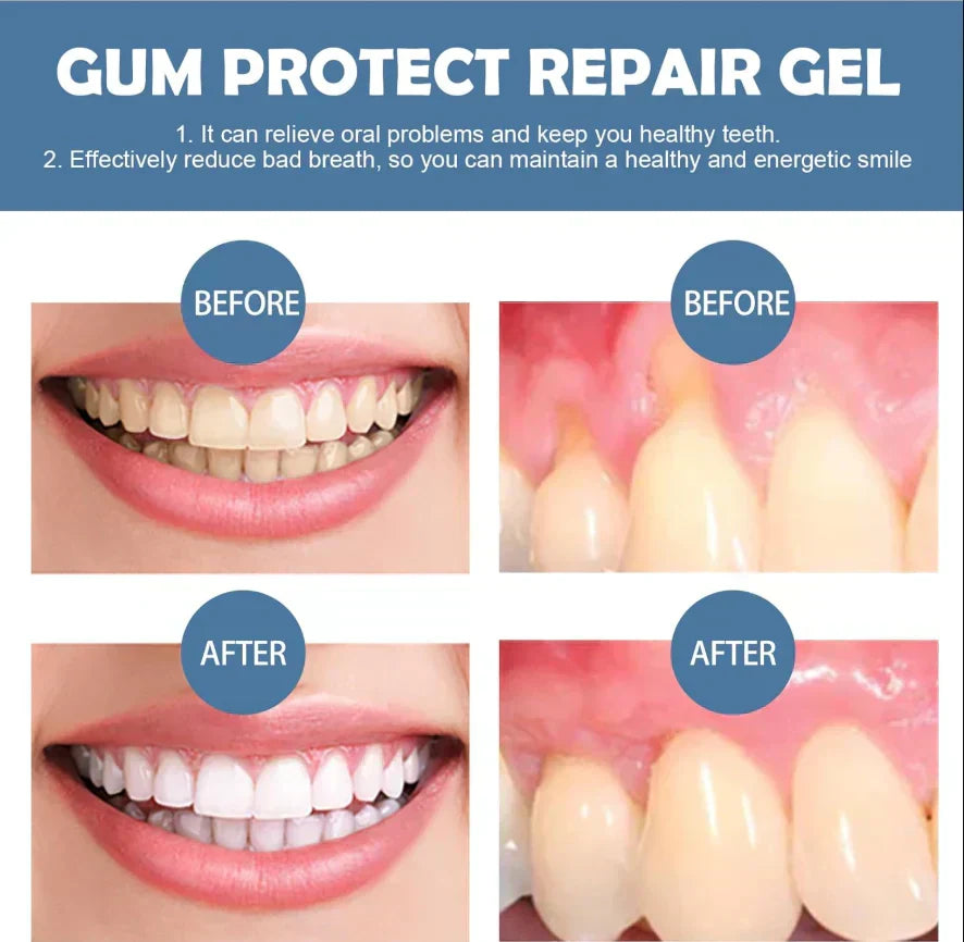 Elyraxo™ Gum Care Gel – Advanced Oral Care for Healthier Gums & A Brighter Smile