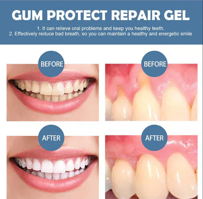 Elyraxo™ Gum Care Gel – Advanced Oral Care for Healthier Gums & A Brighter Smile