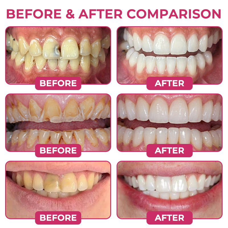 COUGEX®  Cavity-Repair Natural Enamel Filling Gel